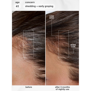 K18 Future IQ Biomimetic Hair Longevity Serum